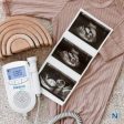 Fetal Doppler Sale